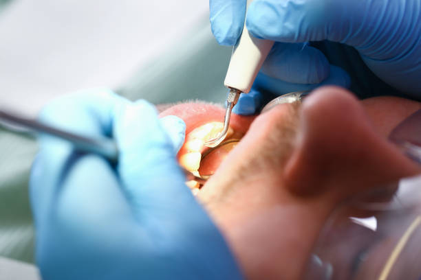 Best Emergency Gum Treatment in Slocom, AL