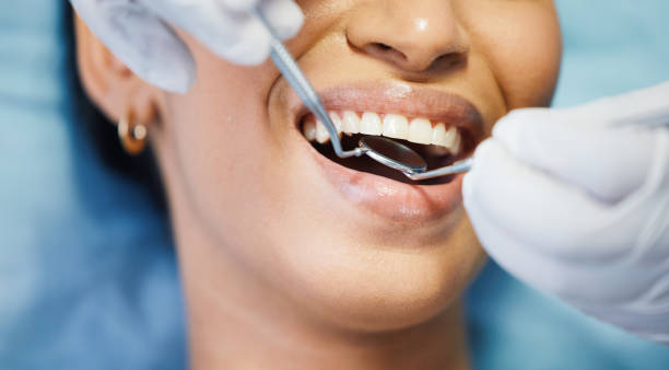 Best Same-Day Emergency Dental Services in Slocom, AL